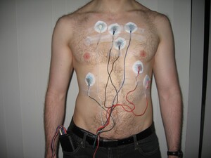 Holter_monitor